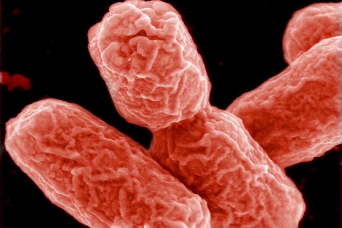 Mueren siete personas por bacteria carnívora en California