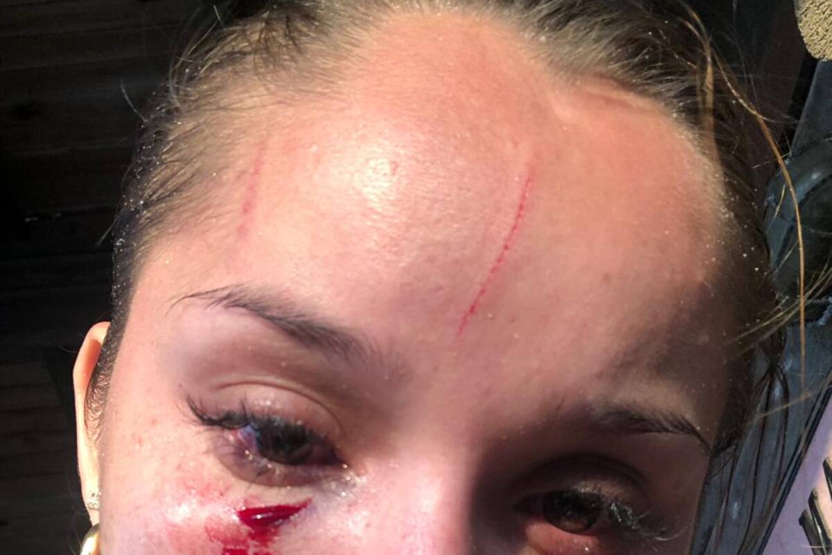 Turistas de Costa Rica dicen que son agredidos en Isla Barú