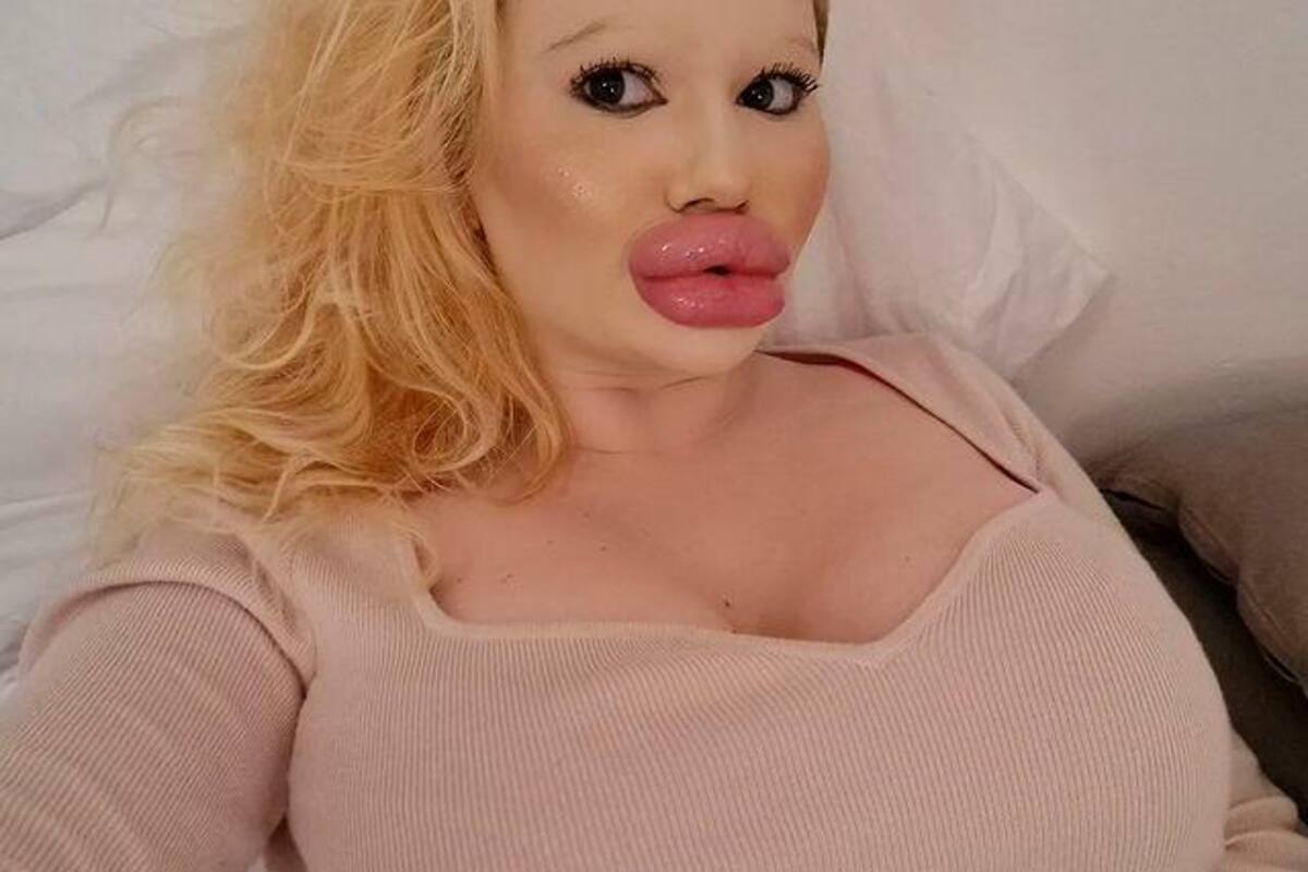 Conoce a Andrea Ivanova, la mujer con los labios más grandes del mundo
