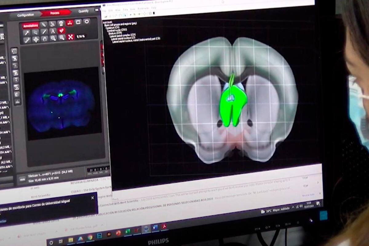 Estos son los 12 avances del cerebro estudiados en 2021