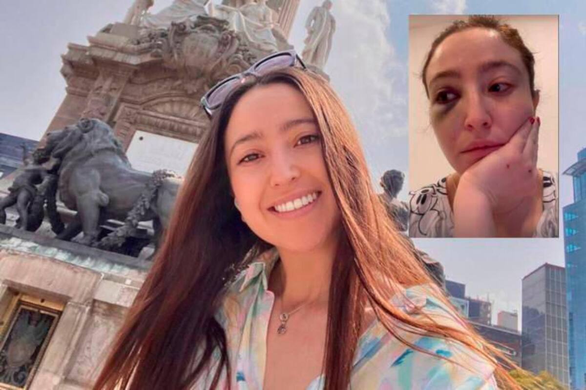 Pesadilla de colombiana en México, su pareja la golpeó y amenazó
