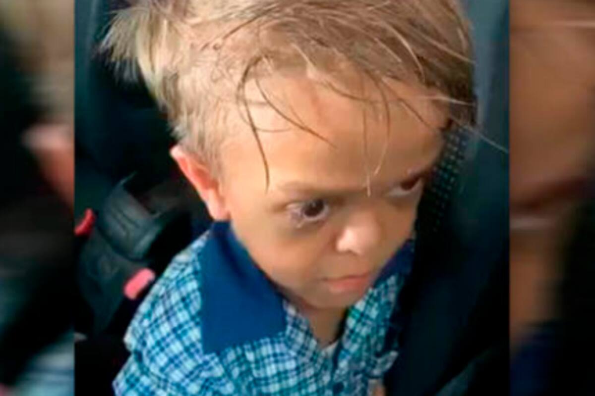 Quadren, el niño que es víctima de bullying por sufrir de enanismo