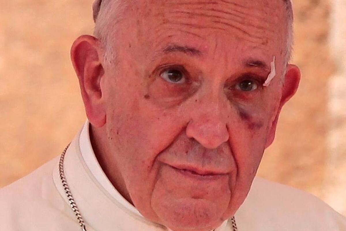 Salud del papa Francisco “mejora progresivamente”