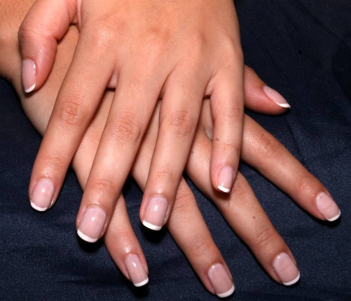 Las principales señales para detectar una infección en las uñas, son los cambios de color, si la uña se pone de color blanco, café o amarillo. ARCHIVO