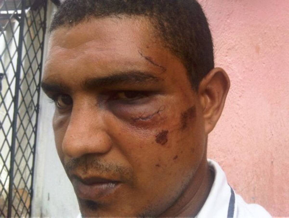 Hernando Barrios Arzuza dice que, sin estar involucrados en los disturbios, el Esmad lo agredió. FOTO CORTESIA