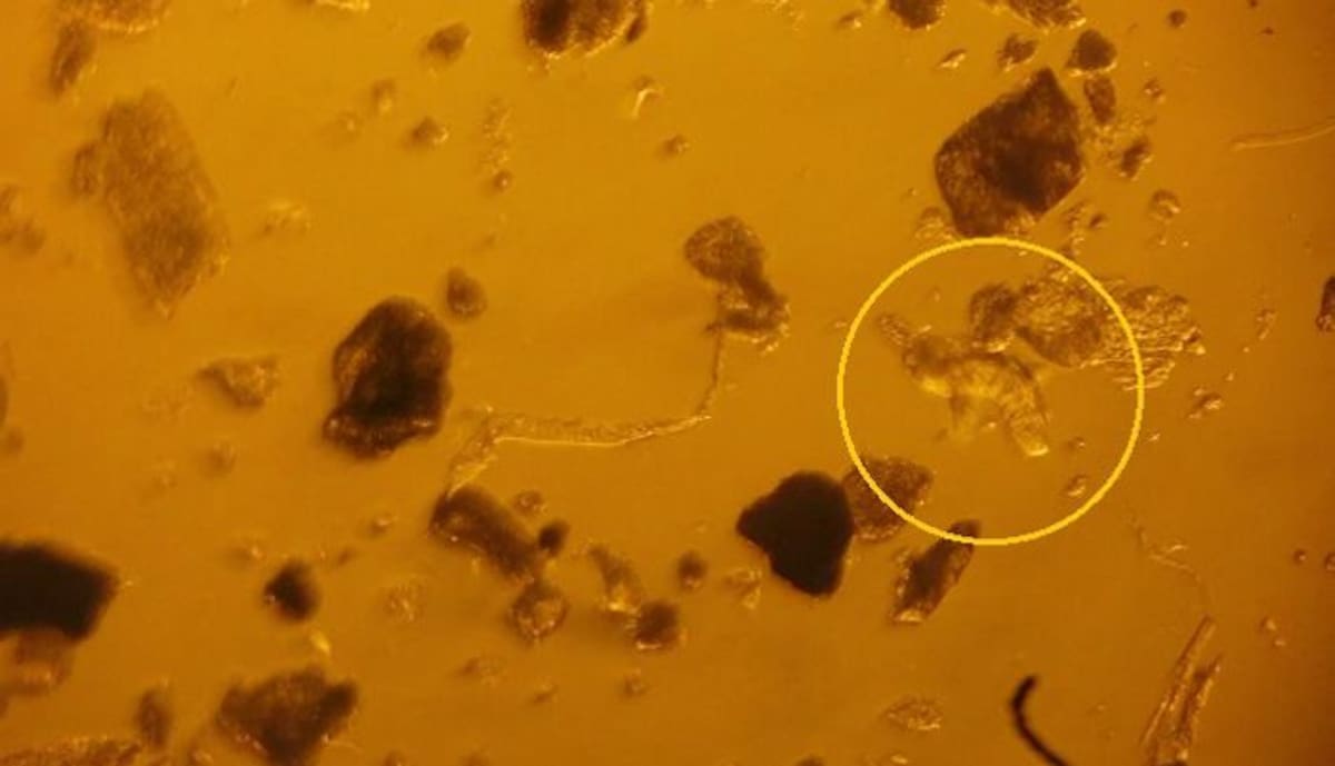 Los tardigrados son microorganismos con una capacidad de resistencia inimaginables en condiciones extremas. Posee una azúcar distinta a la de los seres humanos. Cortesía.