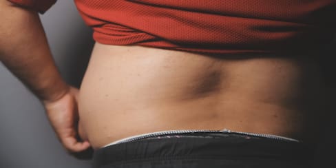 La enfermedad rara que se relaciona con el VIH y crece sin diagnóstico en Colombia
