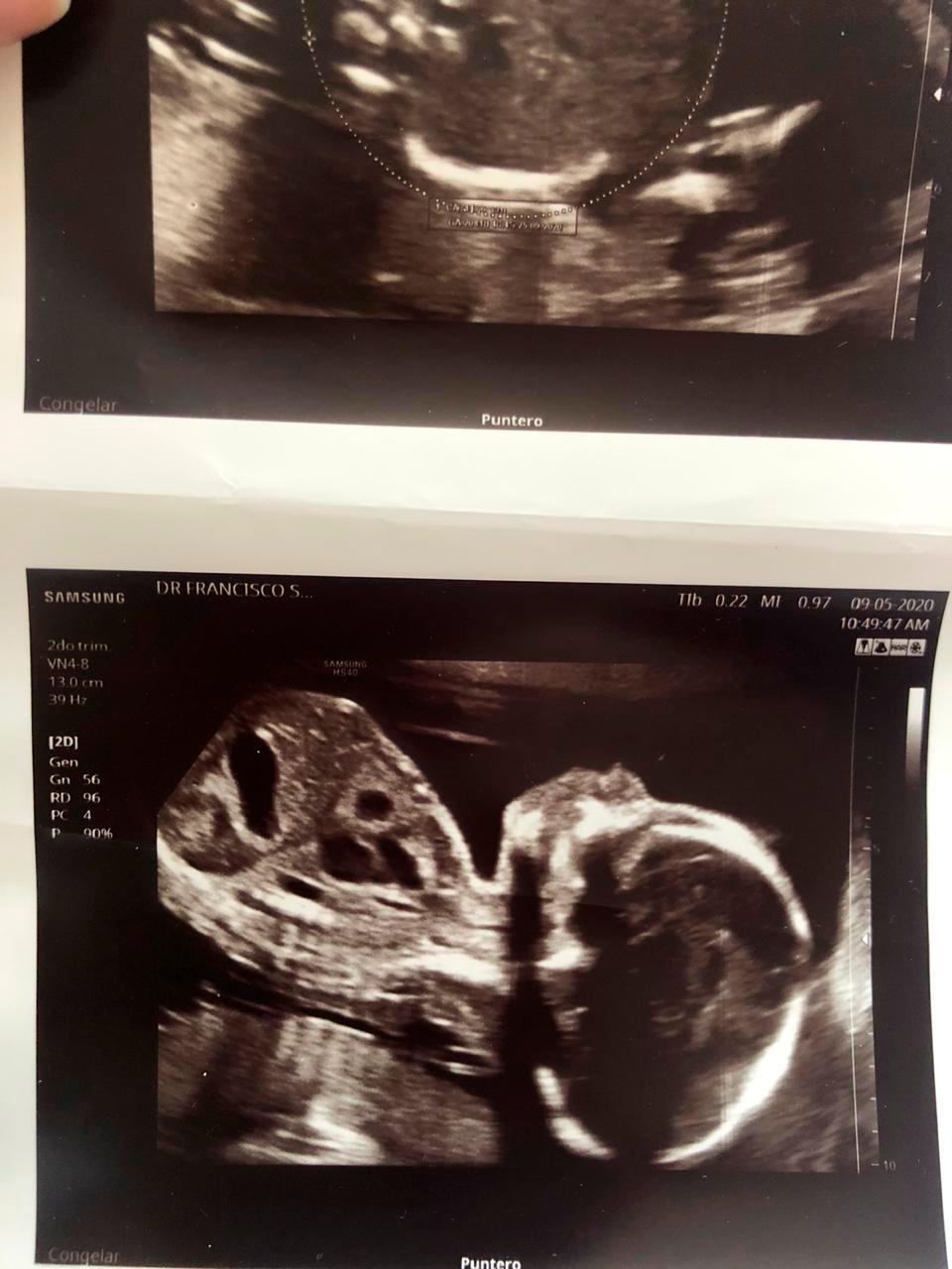 En un mes y una semana llegará a este mundo la bebé Kaila Sofia Hoffman Martínez.