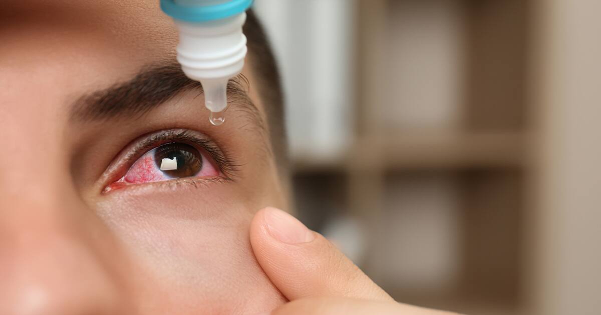 Nodavirus: Aquatic Virus Investigated in Humans Due to Recent Cases