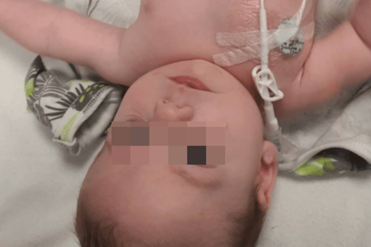 ¡Por el flash! Madre descubre extraño tipo de cáncer en su bebé tras una foto