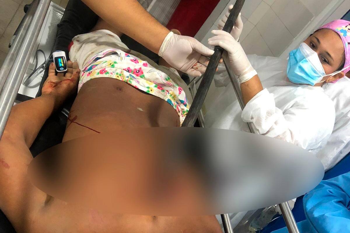 ¡Impactante! Lo agreden con trinche en medio de una riña, en Gambote