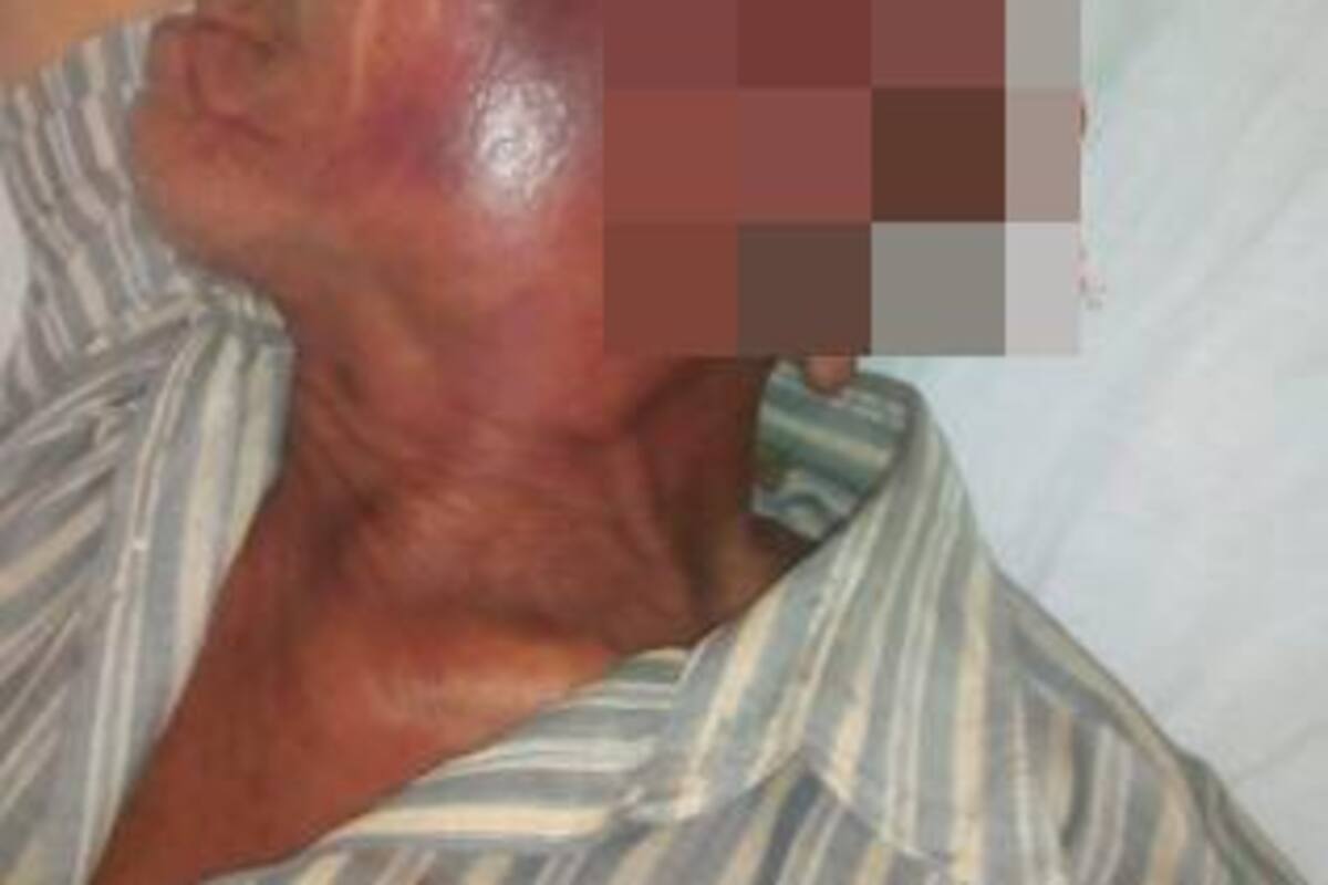 Golpean a anciano en La Quinta para robarle 130 mil pesos