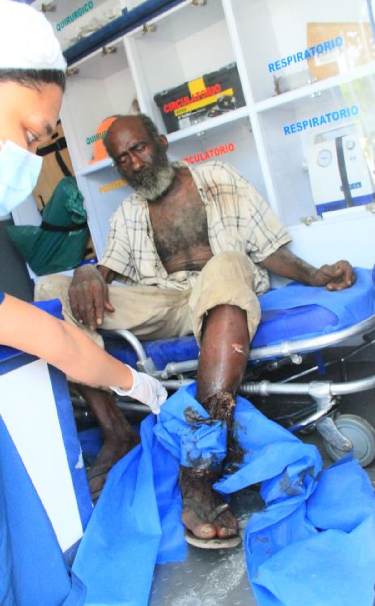 Este es el hombre que tiene una herida llena de gusanos y moscas. ZENIA VALDELAMAR - EL UNIVERSAL