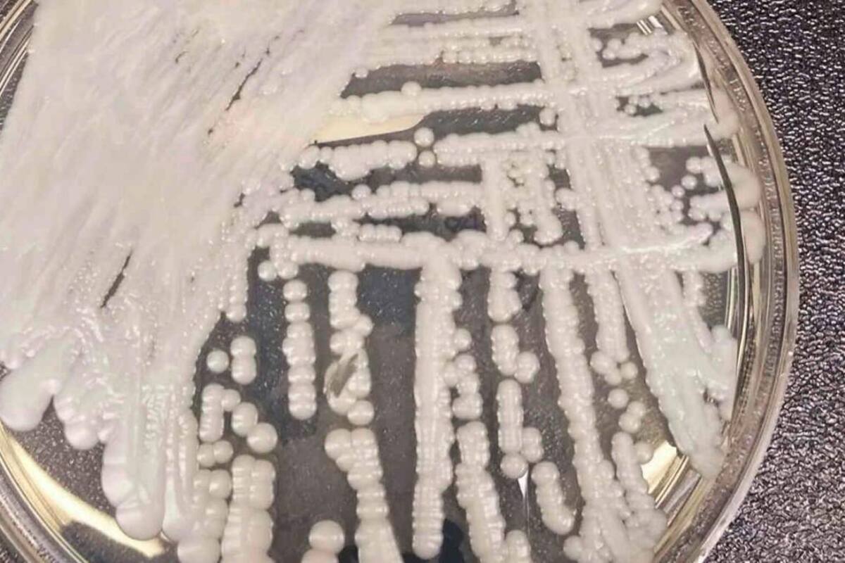 Candida auris, el hongo que causa alerta mundial por su resistencia a medicamentos