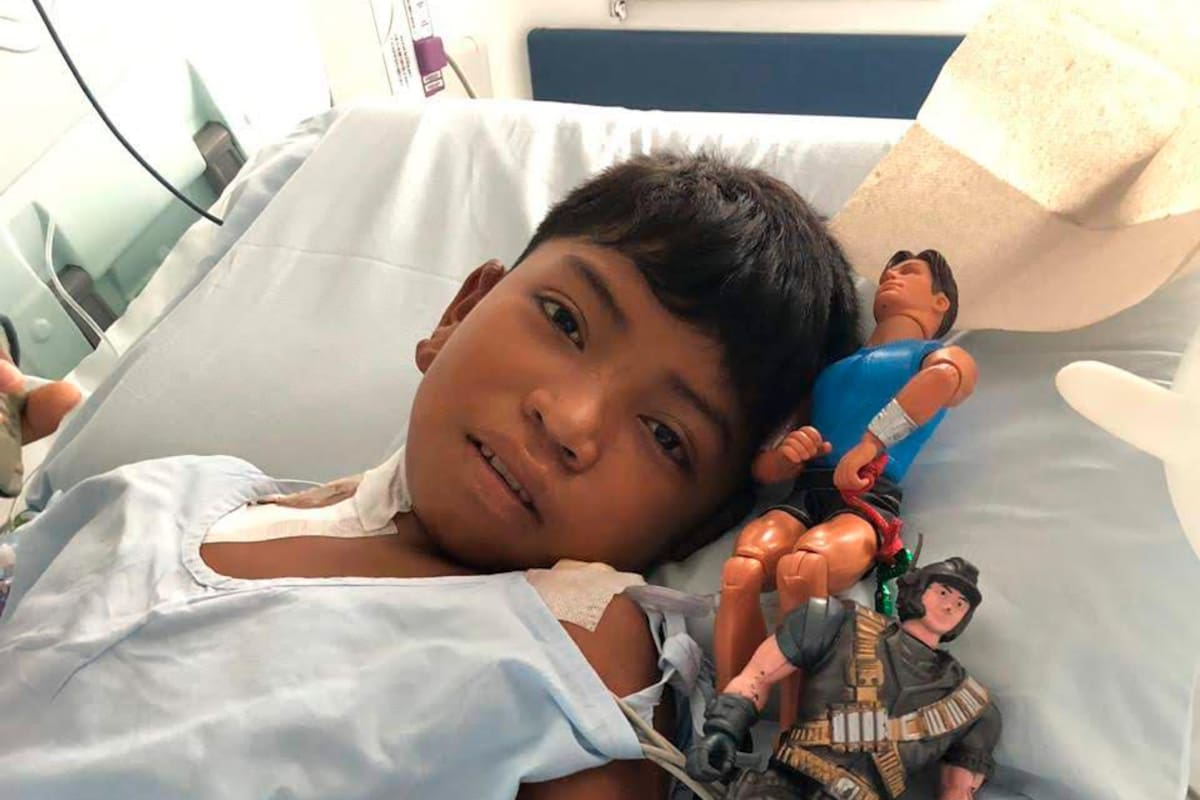 La historia del niño wayuu que volvió a caminar