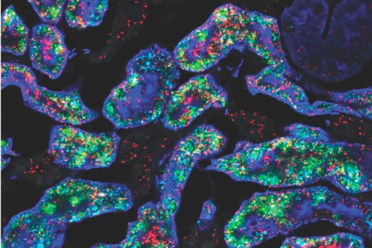 ¿Sabías que los riñones femeninos son más resistentes? Estudio revela la razón