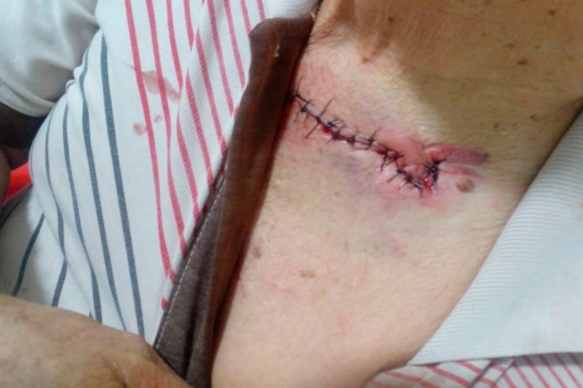 Marialabaja: Brutal ataque de ladrón a dueño de casa que lo pilló robando