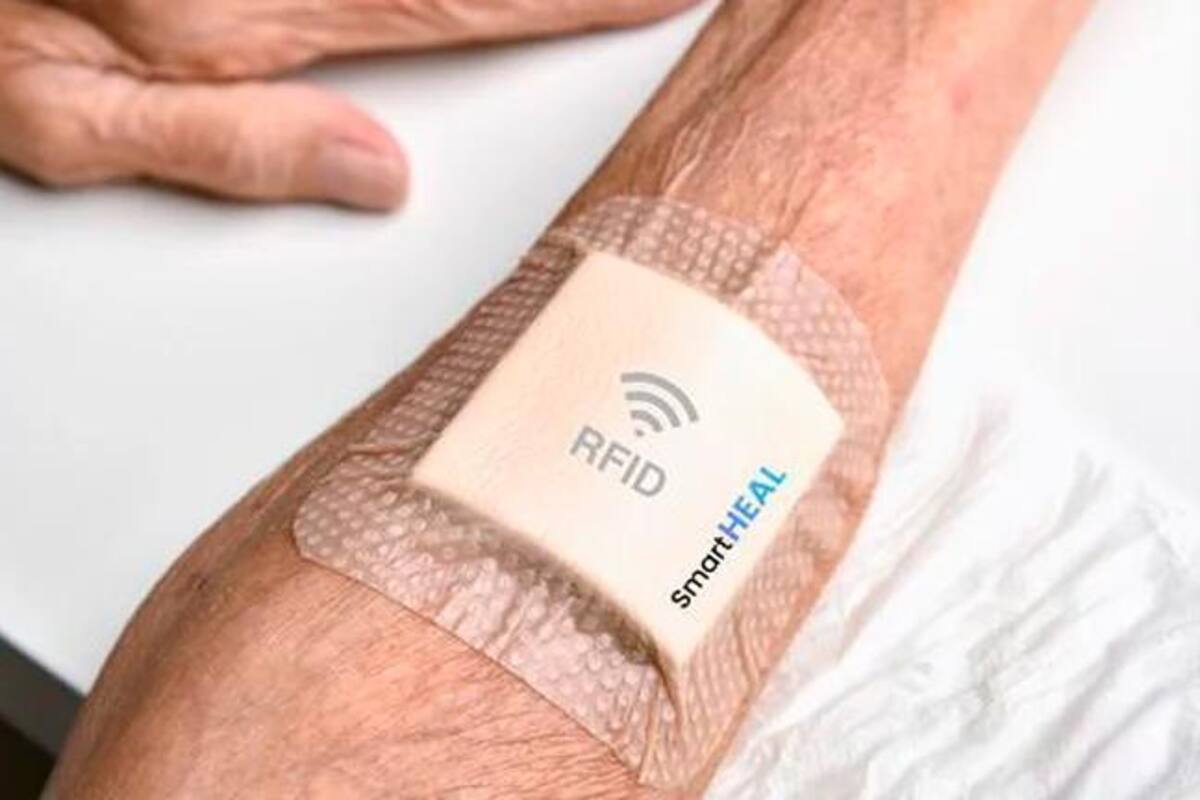‘Curita’ inteligente muestra el tiempo que falta para que sane una herida