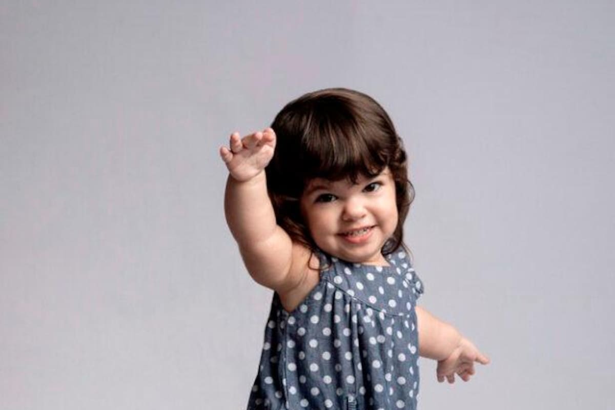 Día de la Acondroplasia y otras displasias esqueléticas que causan enanismo