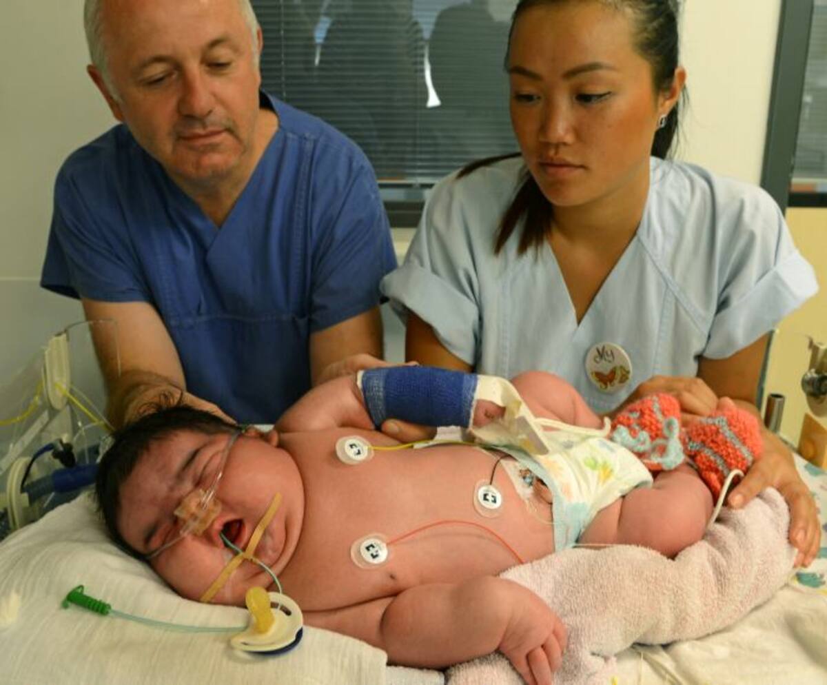 Consultor médico Matthias Knuepfer y la enfermera Mi cuidan del recién nacido más pesado de Alemania hasta el momento en la sala de cuidados intensivos neonatales del Hospital Universitario de Leipzig. AP Waltraud Grubitzsch