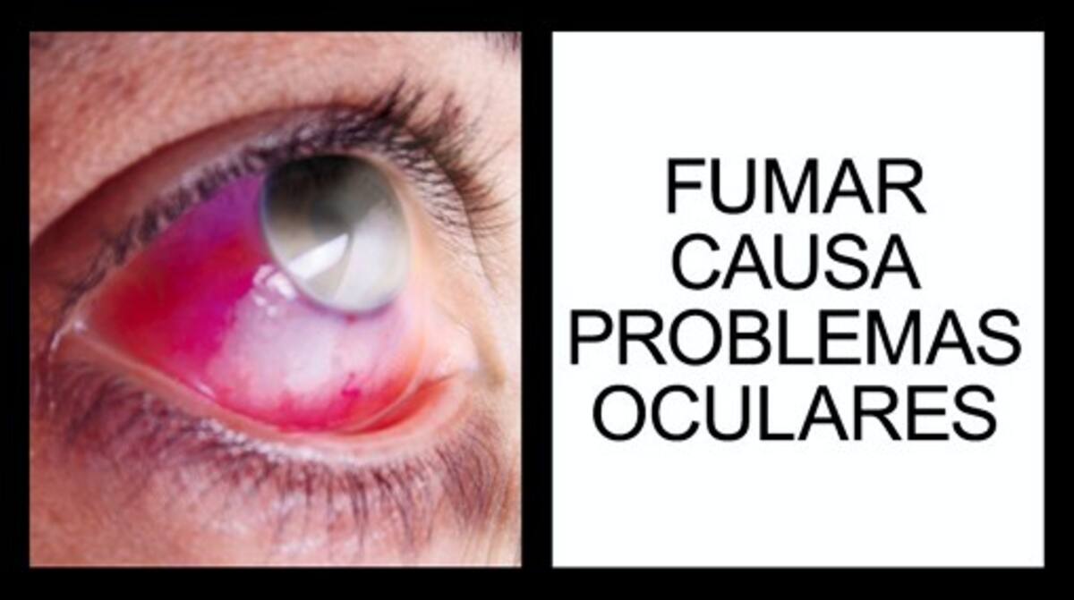 Problemas oculares CORTESIA MINPROTECCION