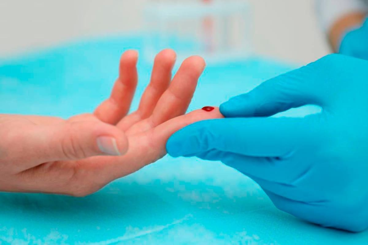 La tamización de infecciones oportunistas: factor clave en personas con VIH