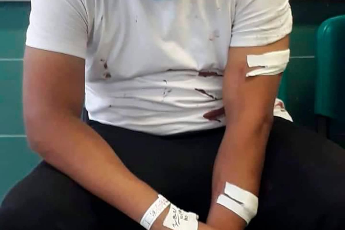 Acuchillan a taxista en aparente atraco, en Albornoz