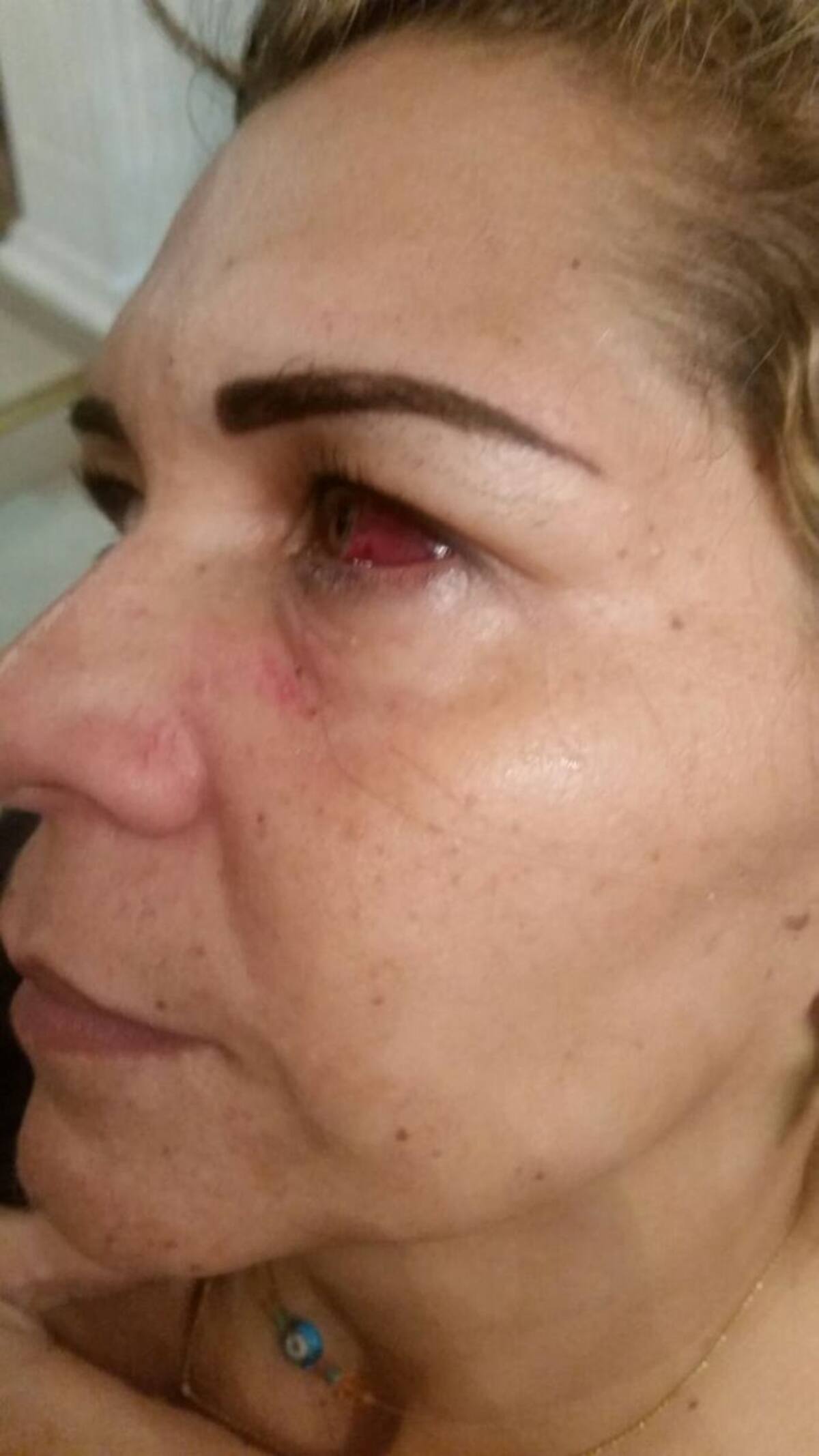 Así quedo la docente Gida Torres tras la agresión. Cortesía