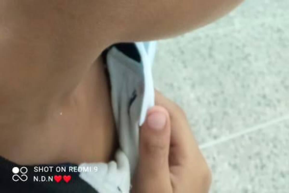 Magangué: le decían “orejón” y su papá le echó gota mágica