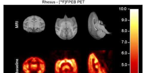 El compuesto que revierte los daños del alzhéimer en las neuronas