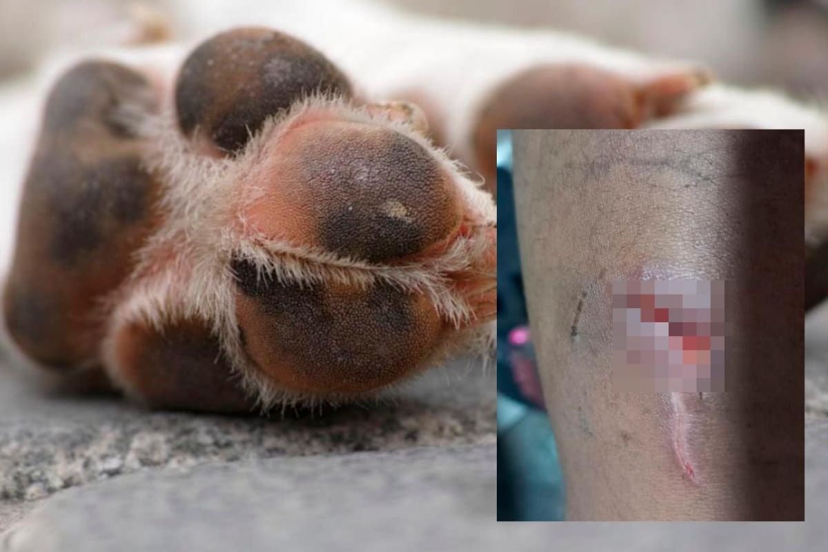 “Fue en defensa propia”: hombre agredió a perro que mordió a su hijo