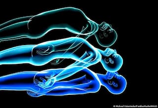 Pacientes relatan experiencias de muerte tras paro cardiaco