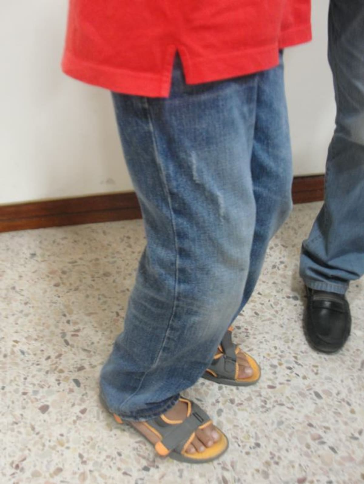 EL diagnóstico de César Luis dice que tiene parálisis cerebral mixta con pie cavo. El Universal