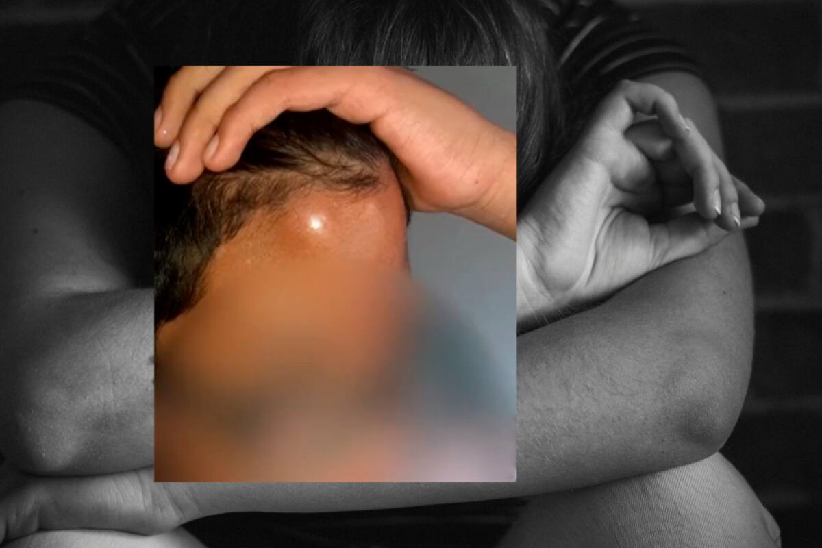 En grave estado: niño de 12 años por presunto caso de matoneo en Bogotá