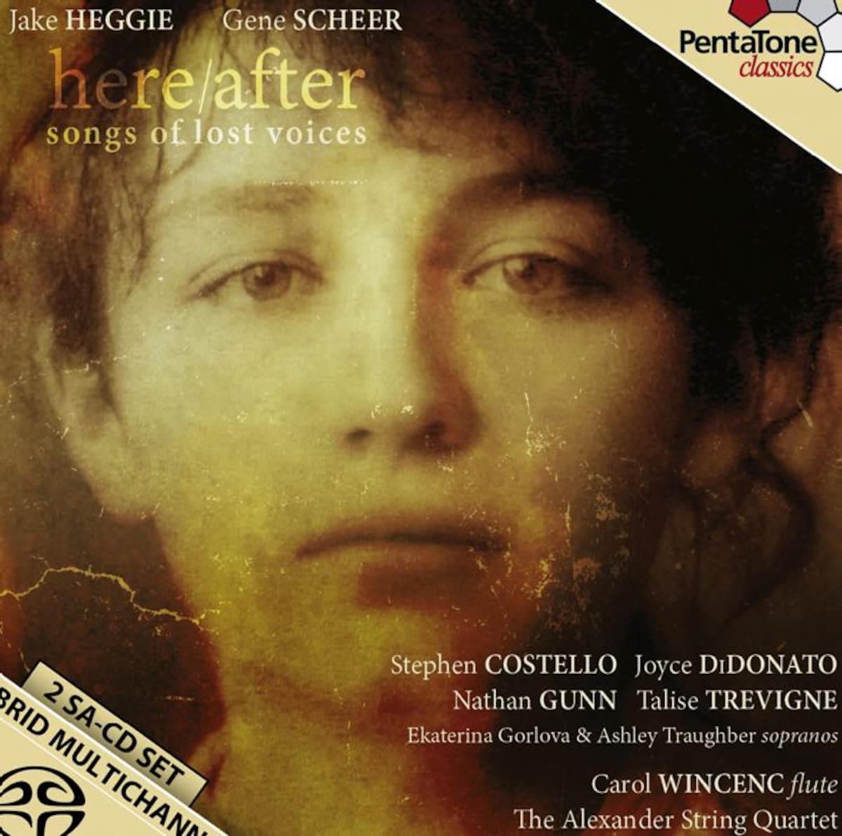 Esta es la portada del disco. AP