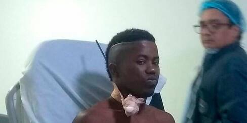 Joven con arpón incrustado en el cuello fue traído a Cartagena