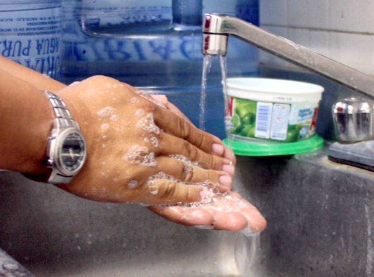 Las medidas preventivas como el lavado de manos son necesarias tenerlas en cuenta como prevención de la enfermedad.