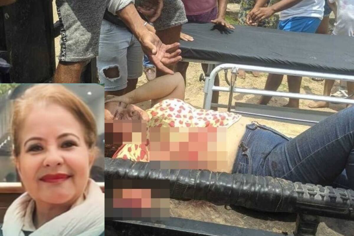 ¡Trágico! Mujer perdió uno de sus brazos en fuerte accidente en Bolívar