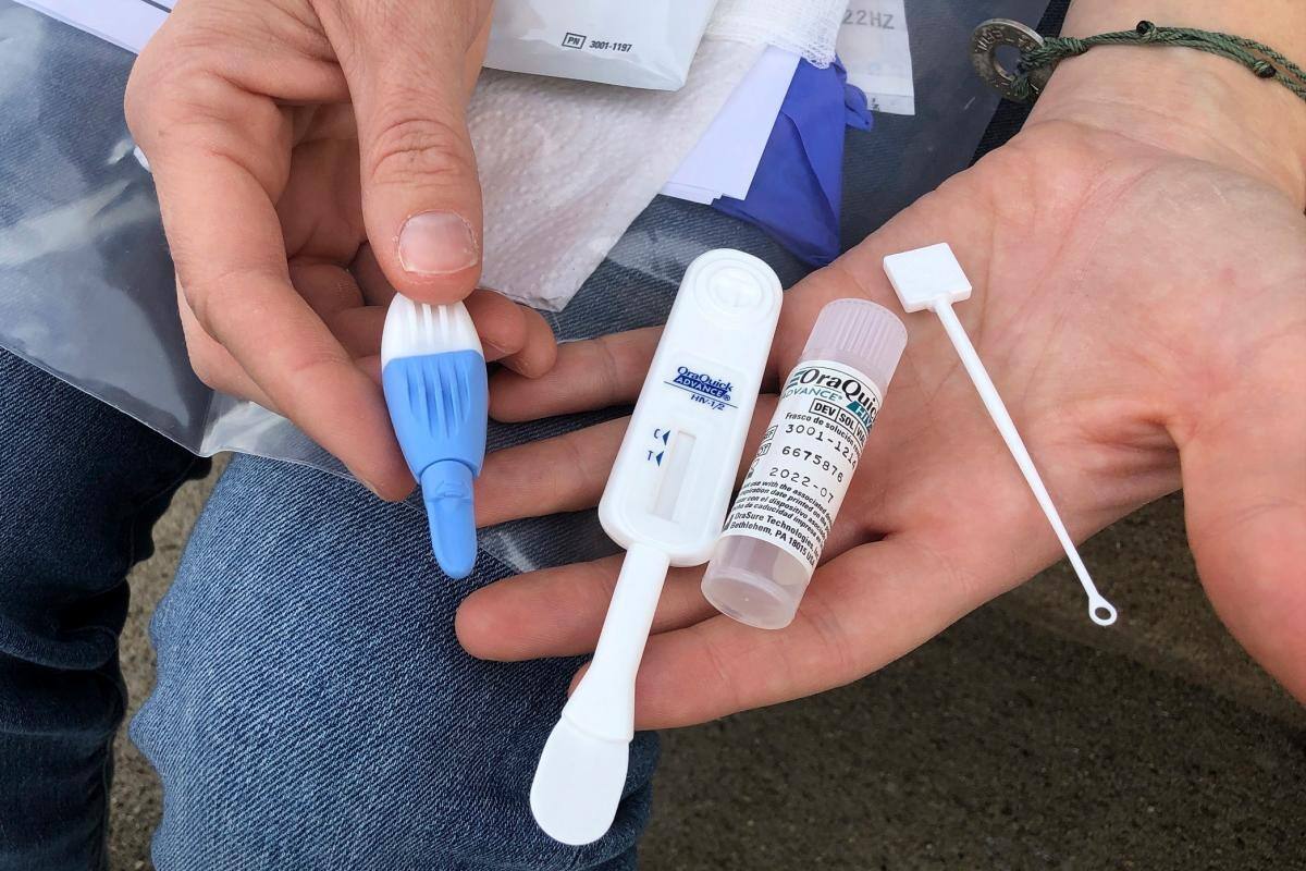 Expertos: pandemia de coronavirus daña batalla contra SIDA
