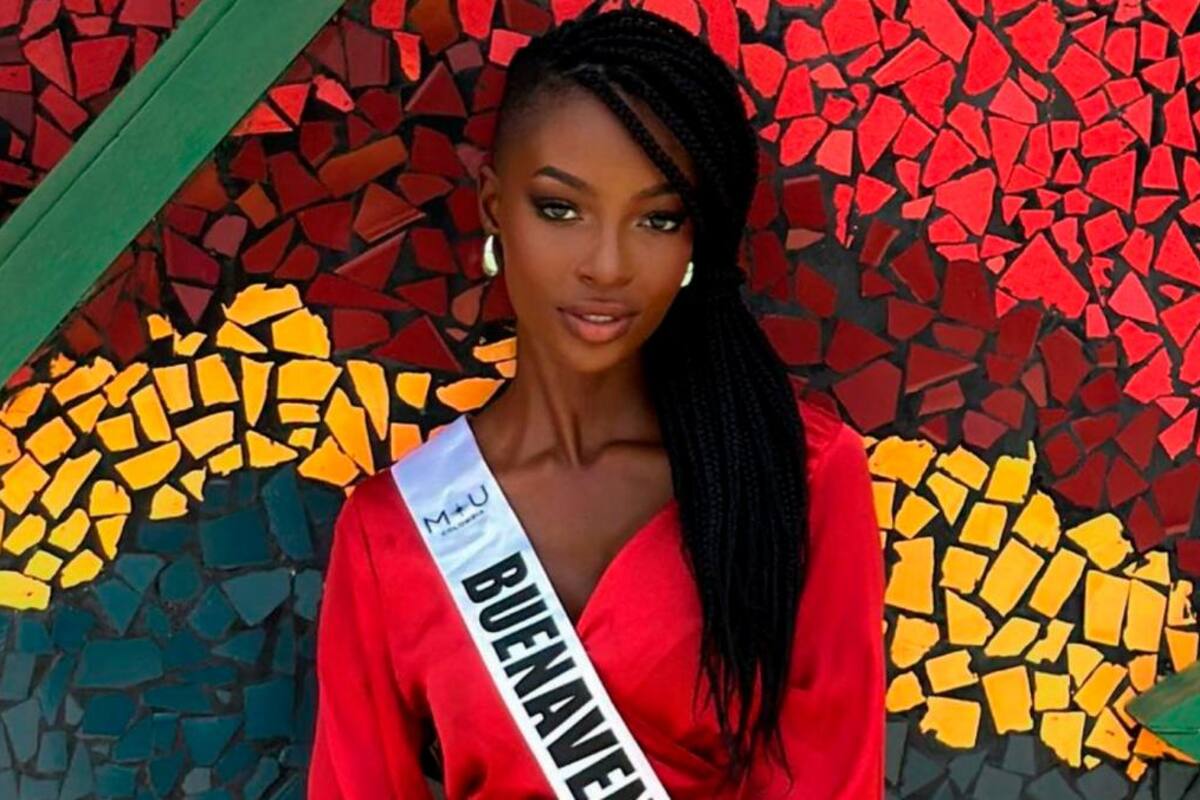 ¡De no creer! Miss Buenaventura usaba clorox para aclarar su piel