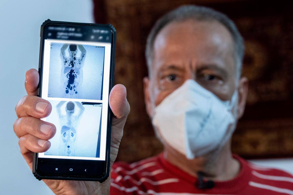 Brasil avanza en terapias y logra la remisión plena del cáncer en un paciente