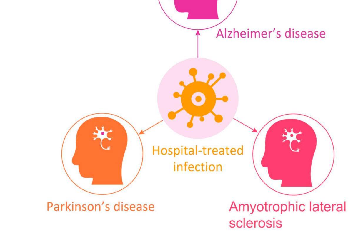 Ojo con las infecciones hospitalarias, elevan el riesgo de alzhéimer