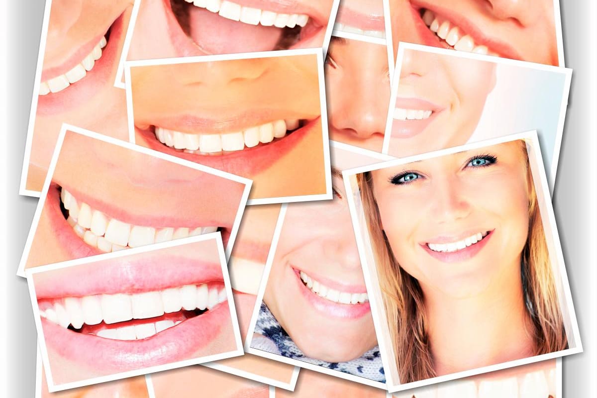 La habilidad es clave en el diseño de sonrisa