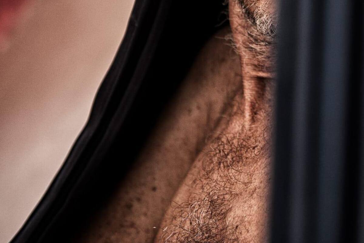 ¿Qué es la Enfermedad de Huntington?, expertos hablarán sobre ella