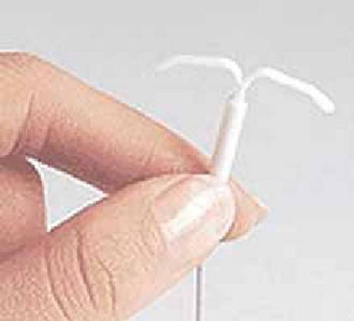 Dispositivo intrauterino -DIU- Cortesía