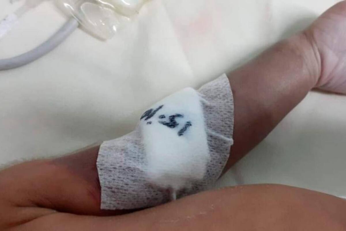 El trágico caso de un bebé recién nacido al que le amputaron un brazo