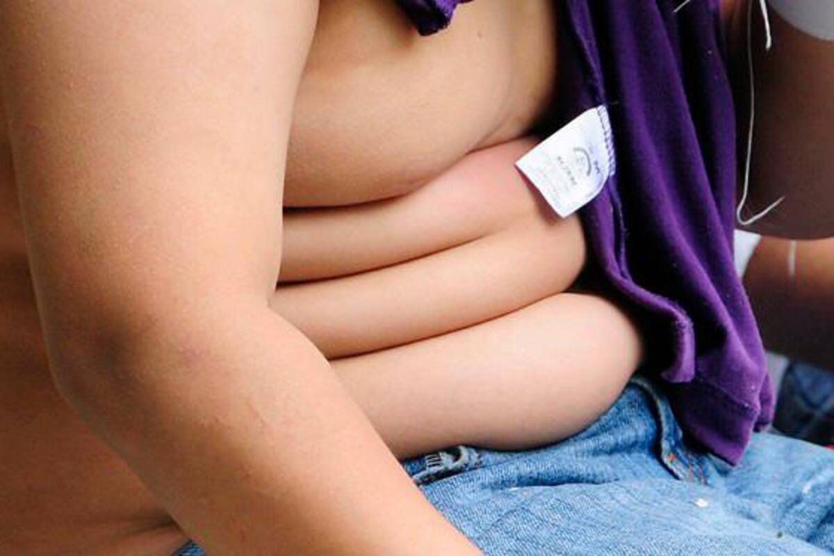 Urgen al Gobierno para reglamentar la ley de obesidad