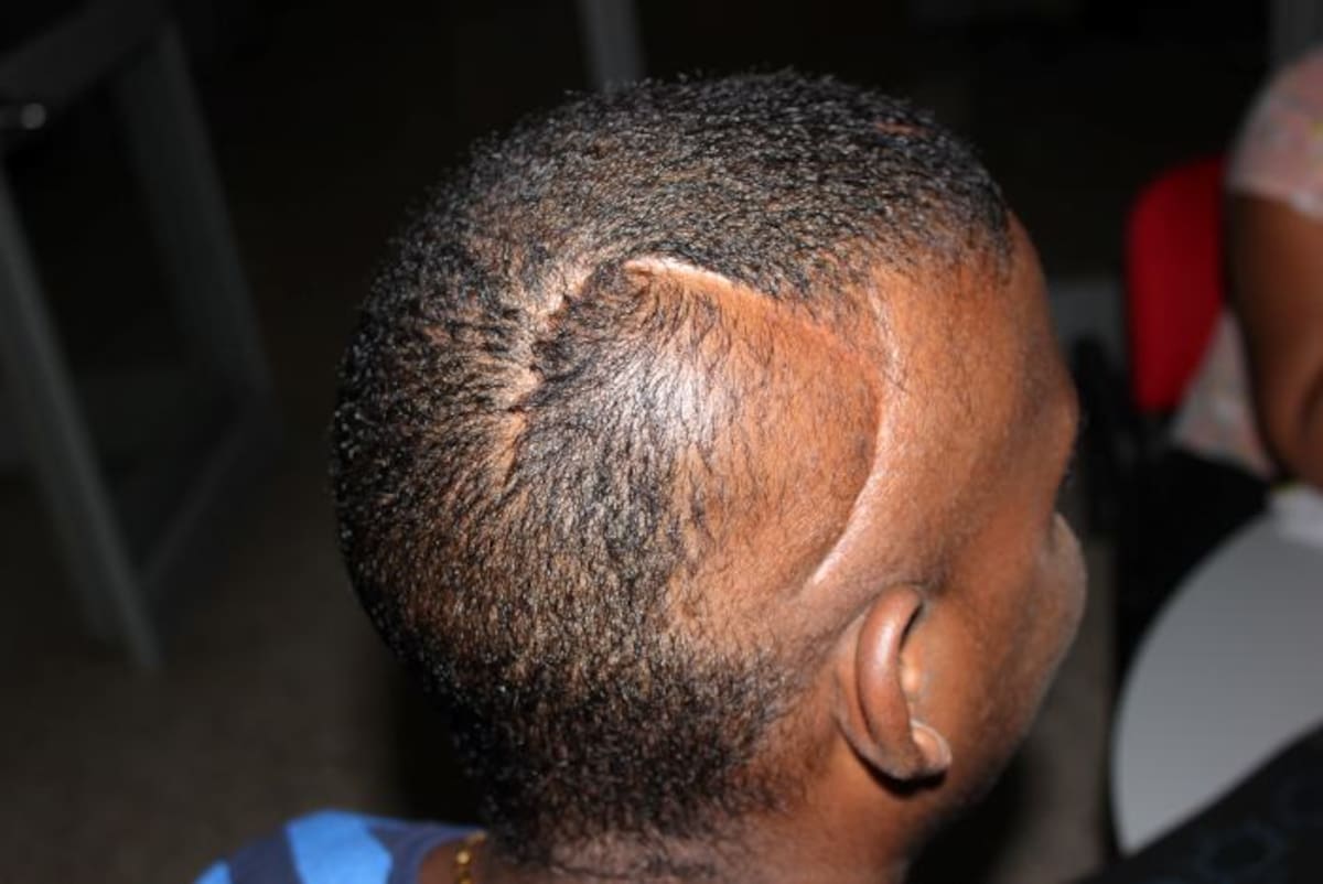 Yesid, al culminar sus estudios, quiere convertirse en neurocirujano para ayudar a los que tienen enfermedades cerebrales. Jairo A. Cárdenas A. - Q'hubo.