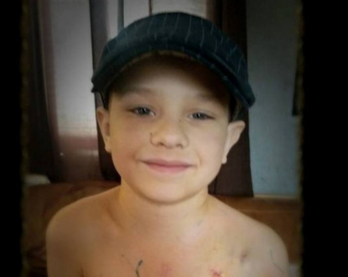 Carter Gentle, niño de 7 años que fue sometido a cinco operaciones a corazón abierto. FACEBOOK