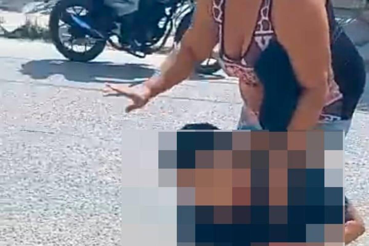 Joven recibe dos balazos en Canapote: su estado de salud es muy delicado